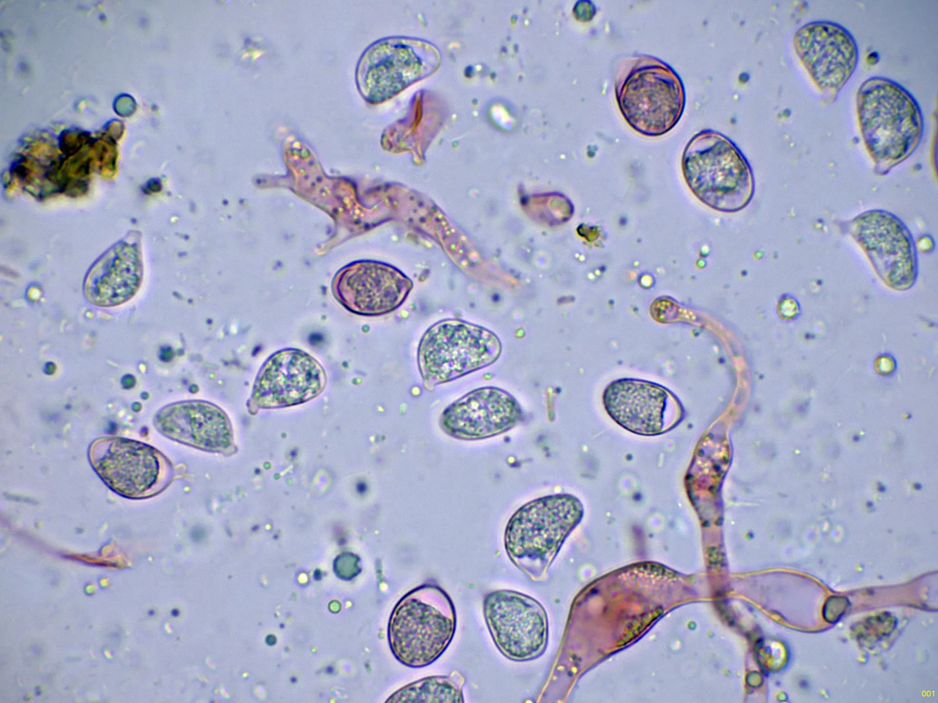 Microscopía de Sebacina epigaea - 10 - Esporas libres -001